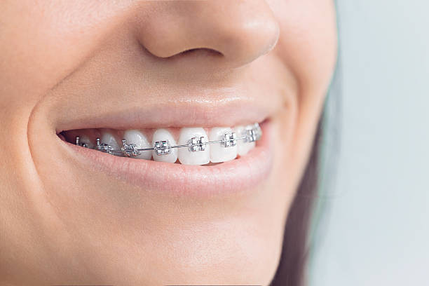 Best Teeth Whitening  in Leland, MS